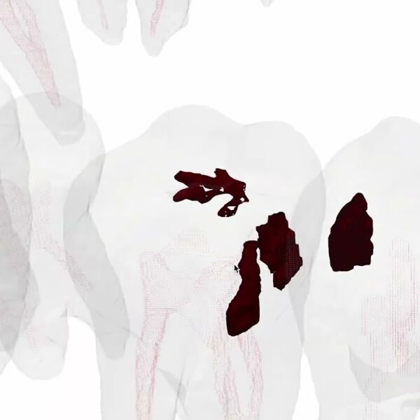 Роботи замінять стоматологів? ШІ-машина провела першу операцію на зубах — ForkLog UA